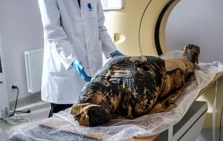 سرطان دلیل احتمالی مرگ نخستین مومیایی باردار مصر باستان