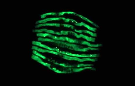 باکتری‌هایی که می‌توانند عامل بروز آلزایمر و پارکینسون باشند