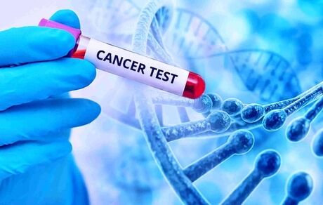 جان باختن ۲۰ هزار نفر در سال به دلیل ابتلا به بیماری سرطان