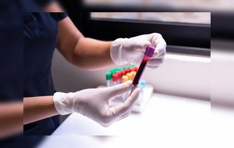 تشخیص چندین نوع سرطان بیماری با یک آزمایش جدید خون 