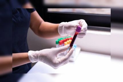 تشخیص چندین نوع سرطان بیماری با یک آزمایش جدید خون 