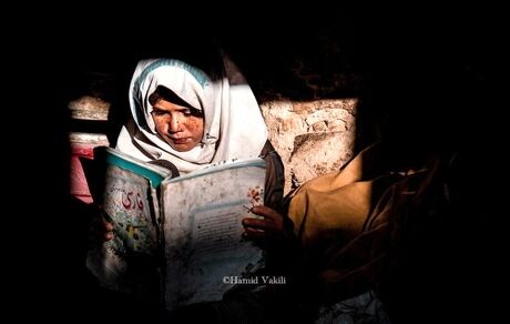 بیماری پوستی نادر و ناراحت کننده در سربیشه استان خراسان جنوبی / عامل: ژنتیکی یا آب آلوده؟