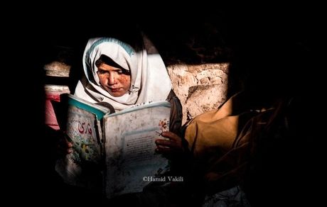 بیماری پوستی نادر و ناراحت کننده در سربیشه استان خراسان جنوبی / عامل: ژنتیکی یا آب آلوده؟