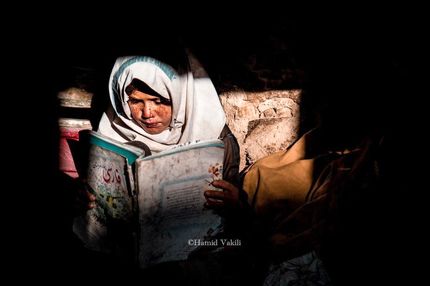 بیماری پوستی نادر و ناراحت کننده در سربیشه استان خراسان جنوبی / عامل: ژنتیکی یا آب آلوده؟