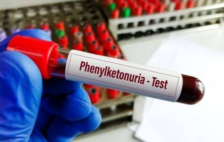 خبر مهم برای بیماران PKU: نان فاقد پروتئین تولید شد