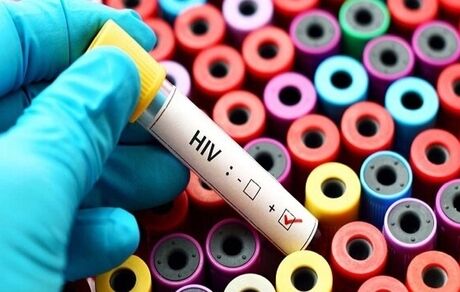 پویش «من هم تست HIV می‌دهم» ادامه دارد