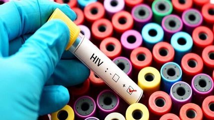 پویش «من هم تست HIV می‌دهم» ادامه دارد