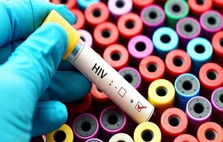پویش «من هم تست HIV می‌دهم» ادامه دارد