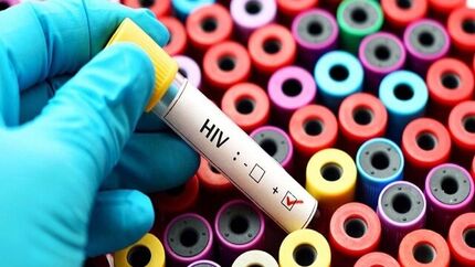 پویش «من هم تست HIV می‌دهم» ادامه دارد