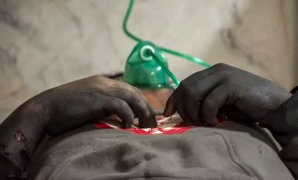 کشته شدن ۲ نفر و مجروحیت ۹۴۵ نفر در چهارشنبه سوری امسال