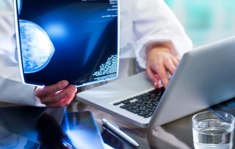تشخیص سرطان پستان با سیستم مبتنی بر هوش مصنوعی گوگل