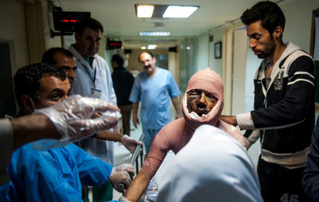 وضعیت بد سوختگی و درمان آن در کشور / چهارشنبه‌سوری، دردسر نسازید