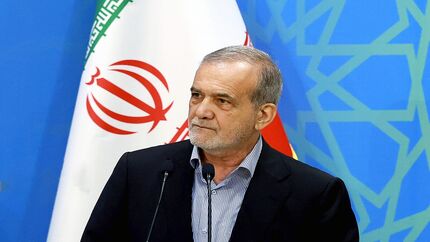 پزشکیان: دنیا زمانی روی آرامش را خواهد دید که به حقوق انسان‌ها احترام بگذاریم