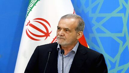 پزشکیان: دنیا زمانی روی آرامش را خواهد دید که به حقوق انسان‌ها احترام بگذاریم