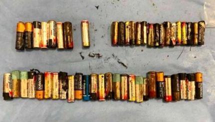 خودکشی زن ایرلندی با ۵۵ باتری قلمی