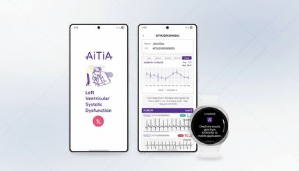 سرویس جدید سامسونگ برای تشخیص زوال عقل عرضه می‌شود