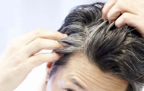 مواد غذایی و ویتامین‌های تاثیر گذار بر سفیدی مو
