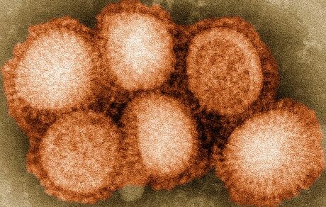 سرایت آنفلوآنزای H5N1 به انسان در اسپانیا ثبت شد
