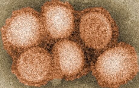 سرایت آنفلوآنزای H5N1 به انسان در اسپانیا ثبت شد