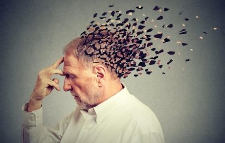 روش جدید برای تشخیص آلزایمر اعلام شد