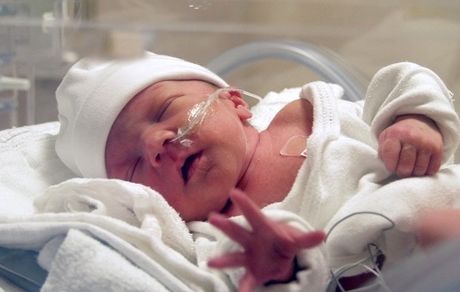 مرگ نوزاد؛ نتیجه زایمان‌‌های تقویمی 