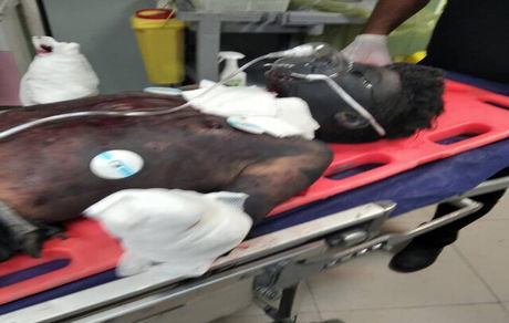 قطع دستان نوجوان شیرازی حین ساخت ترقه برای چهارشنبه سوری