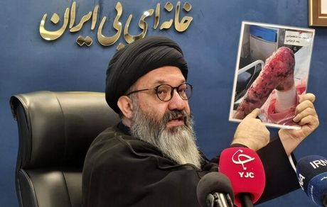 شناسایی ۱۲۵۰ بیمار ای‌بی در کشور