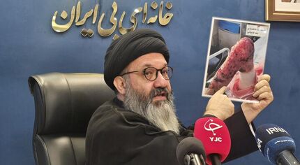 شناسایی ۱۲۵۰ بیمار ای‌بی در کشور