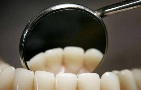 ارتباط عجیب زودتر مردن با دندانها