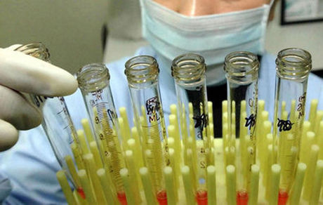 کاربرد سلول‌های بنیادی در درمان ۳۰ بیماری/ لزوم افزایش تنوع "قومیتی" در اهدای این سلول‌ها