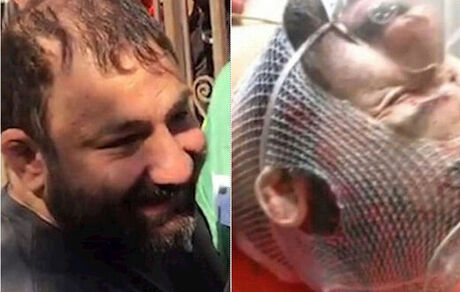 عکس| نوشته پشت در اتاق «هانی کرده» در بیمارستان