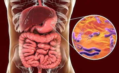 رژیم غذایی افراد مبتلا به زخم معده