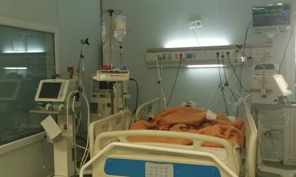سوختگی شدید ۳ کودک به دلیل آتش‌بازی استقبال از چهارشنبه سوری در فارس