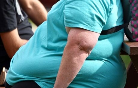 نیمی از مبتلایان به کرونا در آمریکا افراد چاق هستند