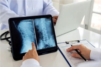 ژاپنی‌ها با روش سلول بنیادی، دو معلول نخاعی را درمان کردند