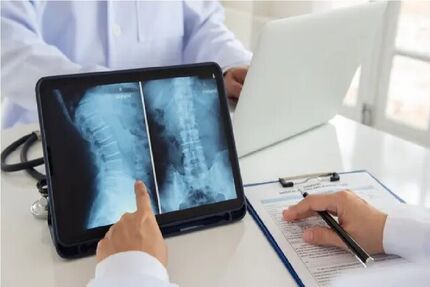 ژاپنی‌ها با روش سلول بنیادی، دو معلول نخاعی را درمان کردند