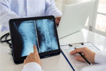 ژاپنی‌ها با روش سلول بنیادی، دو معلول نخاعی را درمان کردند