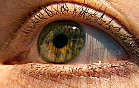 علائم و خطرات "سکته چشمی"