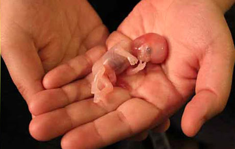 لزوم اصلاح معایب قانون «جوانی جمعیت»/ فرصت یک هفته‌ای؛ ناکافی برای صدور جواز سقط