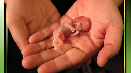 لزوم اصلاح معایب قانون «جوانی جمعیت»/ فرصت یک هفتهای؛ ناکافی برای صدور جواز سقط