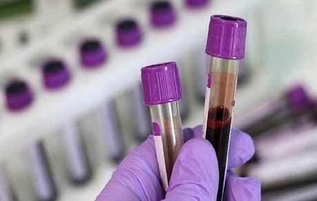 توضیح وزارت بهداشت درباره "کمبود کیتهای آزمایشگاهی"