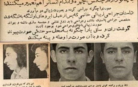 اولین عمل بینی در ایران کی بود؟