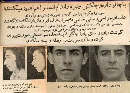 اولین عمل بینی در ایران کی بود؟