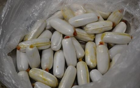 کشف ۲۳ بسته هروئین از معده  یک تبعه افغانستانی در مرز دوغارون