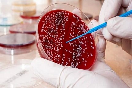 موفقیت محققان ایرانی در دست ورزی ژنتیکی سلولی برای درمان سرطان