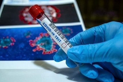 اعلام جدیدترین فهرست آزمایشگاه‌های تشخیصی کووید ۱۹