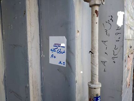 ۲۱۴۶ بیمار در صف پیوند کلیه/ هشدار درباره دیوارنوشته‌های کلیه‌فروشی