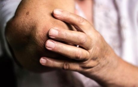 چاقی، تلفن‌همراه و کامپیوتر بلای جان مفصل‌ها!