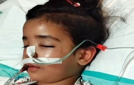 کودک ۴ ساله شکنجه شده توسط نامادری جان باخت