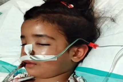 کودک ۴ ساله شکنجه شده توسط نامادری جان باخت
